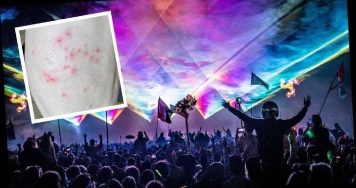 Partys, Sex und Darkrooms: RKI gibt neue Hinweise zum Schutz vor Affenpocken-Infektionen